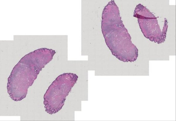 Real fluorescence microscopy demo scan